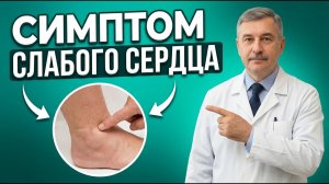 Как Предотвратить СЕРДЕЧНУЮ НЕДОСТАТОЧНОСТЬ И Укрепить Сердце В ДОМАШНИХ Условиях? Советы КАРДИОЛОГА