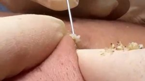 🌾 Очищение и омоложение кожи с помощью ухода за лицом
