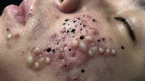 🧖 Нежное очищение лица и уход за кожей для глубокого расслабления
