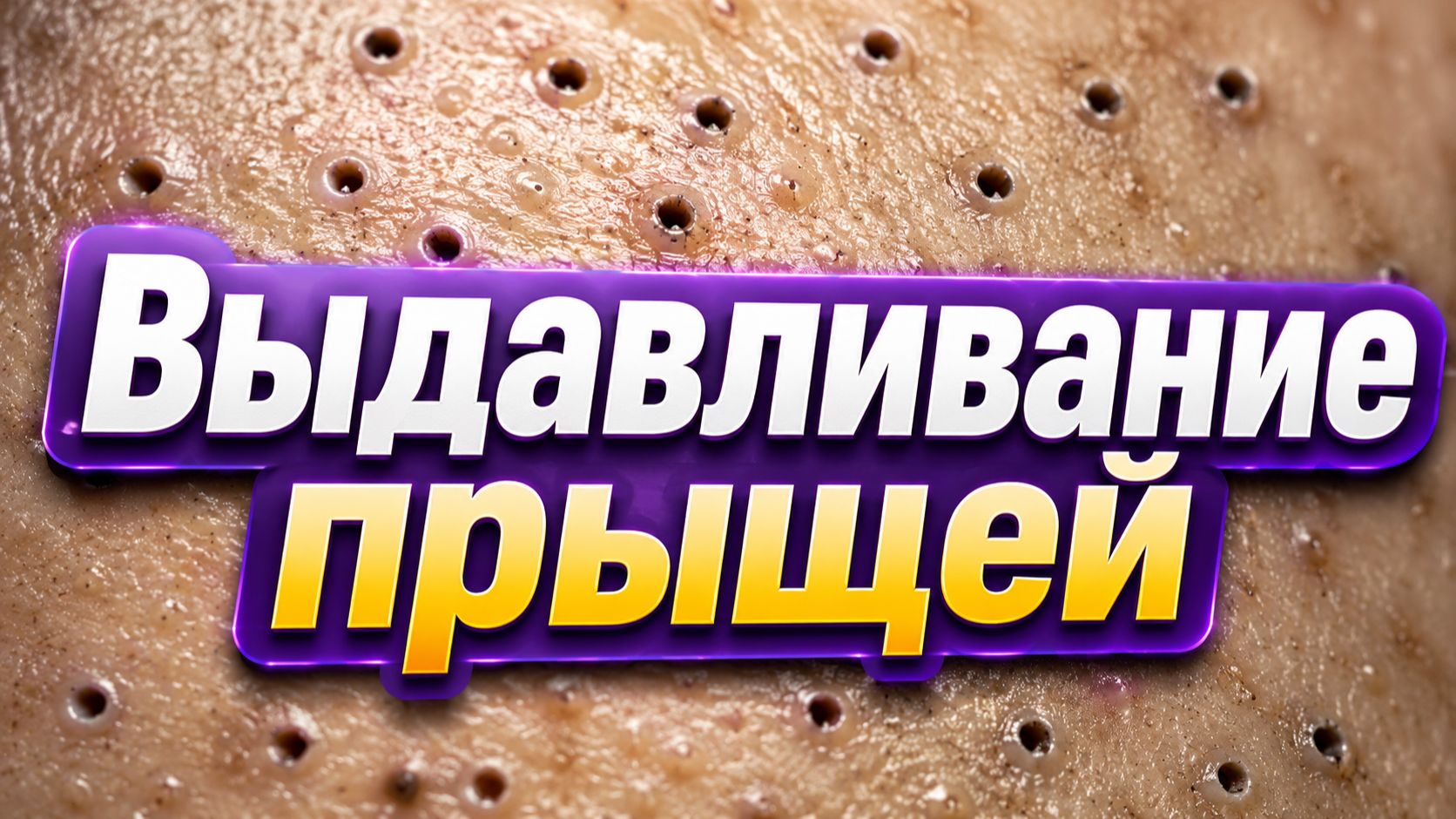 Отличное качество! Удаление прыщей часть #5.