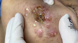 Советы по уходу за кожей лица 🧼