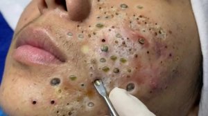 🧖 Нежное очищение лица и уход за кожей для глубокого расслабления
