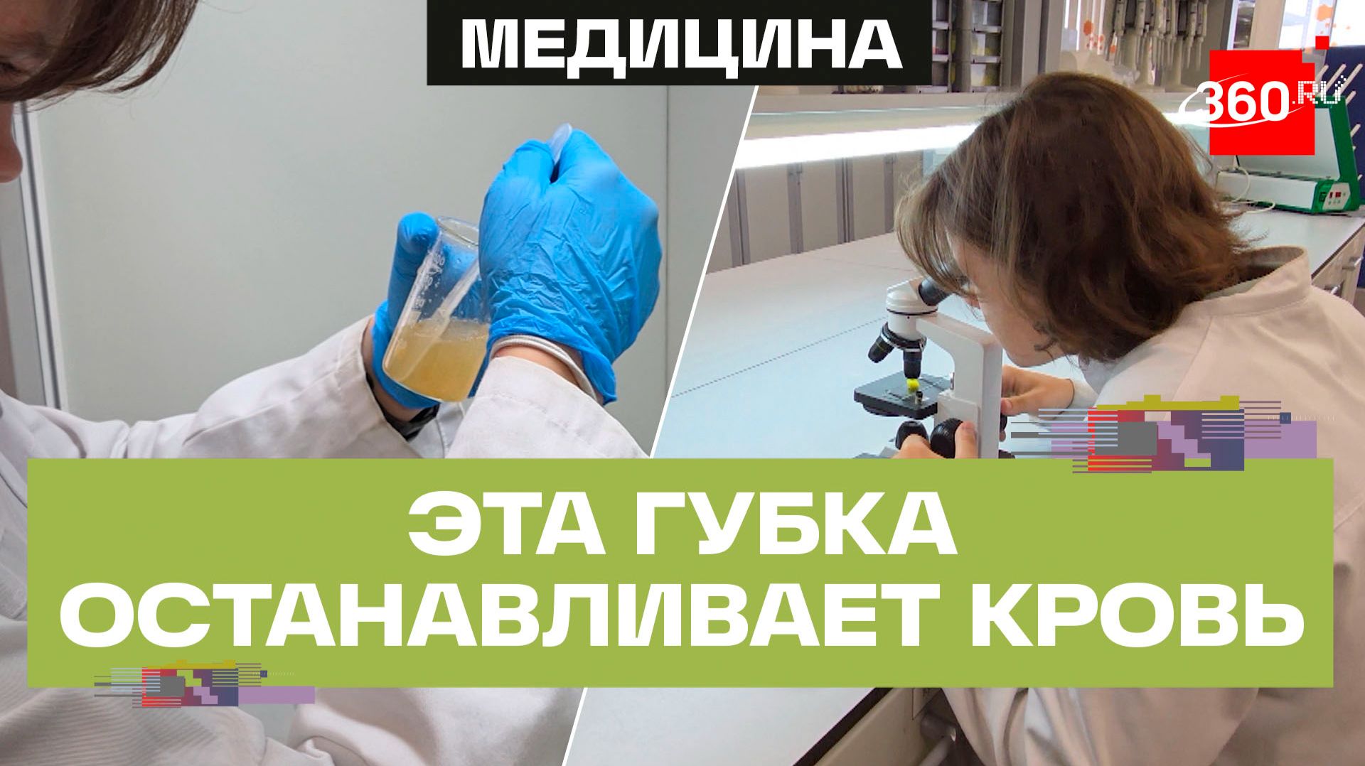 Школьница из Москвы разработала губку, которая останавливает кровотечение смотреть онлайн