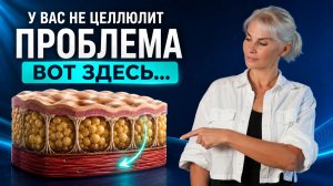 ДЕЛАЙТЕ ЭТИ УПРАЖНЕНИЯ 5 МИНУТ в ДЕНЬ— ЦЕЛЛЮЛИТ  ИСЧЕЗНЕТ НА ГЛАЗАХ