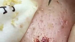 Расслабляющая чистка пор для мягкой кожи