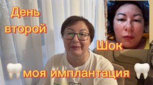 ШОК 😳 День второй после имплантации ☑️ Серия 6