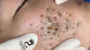 Внутренний покой с этими методами очищения лица