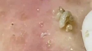 Советы по очищению и уходу за лицом 🧼✨