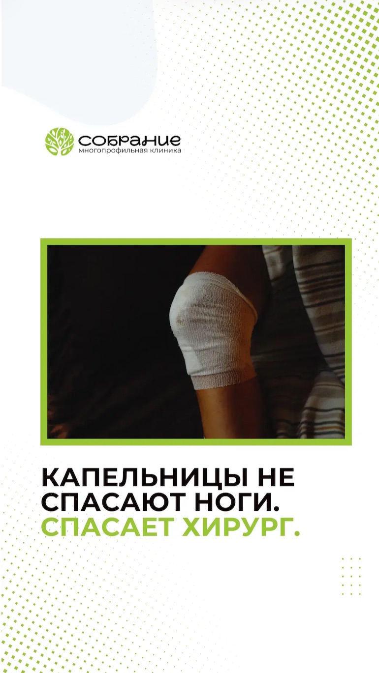 Капельницы не спасают ноги. Спасает хирург🔥