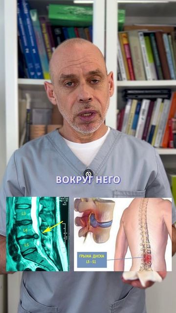 НОГА БОЛИТ из-за проблем в пояснице? При ОСТЕОХОНДРОЗЕ шейного отдела помогает ВОРОТНИК ШАНЦА?