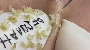 Расслабляющая чистка пор для мягкой кожи