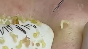 Расслабляющая процедура очищения пор для мягкой кожи