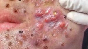 Расслабляющая чистка пор для мягкой кожи 🧖♀️