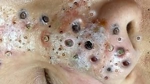 Расслабляющая чистка пор для мягкой кожи