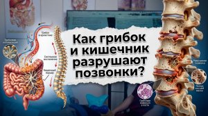 Артрит, артроз, остеохондроз, истории болезней