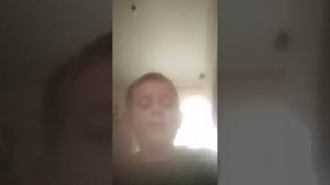 спалил лицо + новые способности моего ось