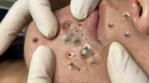 Расслабляющая процедура очищения пор для мягкой кожи