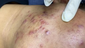 Успокаивающее расслабление