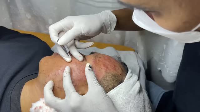 Ручная чистка лица — полный процесс смотреть онлайн