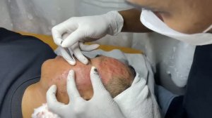 Ручная чистка лица — полный процесс