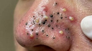 🧖 Мягкое очищение лица и уход за кожей для глубокого расслабления