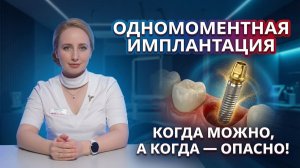 Одномоментная имплантация: полный разбор метода установки импланта после удаления зуба.