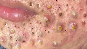 Советы по очищению и уходу за лицом 🧴🧼