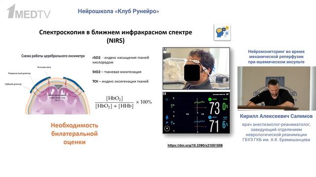 Нейромониторинг во время механической реперфузии при ишемическом инсульте Салимов К.А. 2026