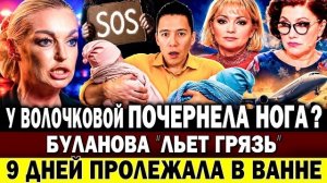 У Волочковой почернела нога - СМИ. Буланову обвинили - «льет грязь». Сябитова возмущена астрологами