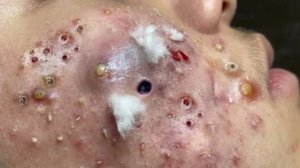 Успокаивающий уход за лицом для снятия стресса в спа-салоне