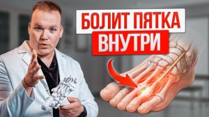 Что такое Неврома Мортона. Как УБРАТЬ БОЛЬ в стопе делая 3 упражнения