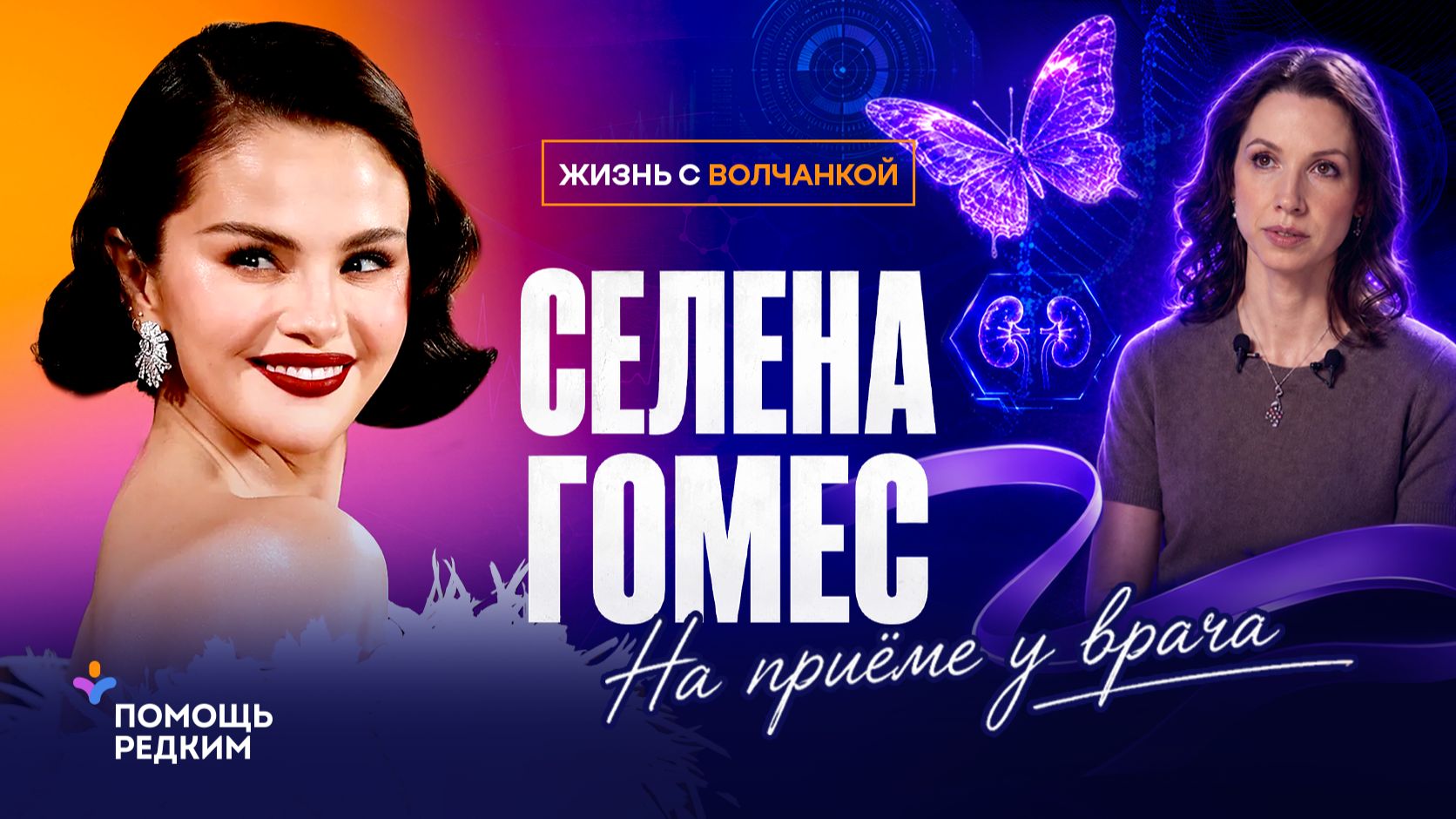 Селена Гомес и «волчья» болезнь: мифы и правда о системной красной волчанке