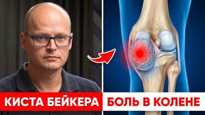 Киста Бейкера и нестабильное колено: ищем причину через ММТ