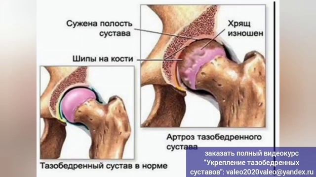 Беспокоят крестец, поясница, тазобедренные суставы?
Освободите линию 