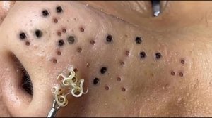 Успокаивающий уход за лицом для снятия стресса в спа-салоне