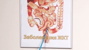 Целлюлит, остеохондропатия, варикоз, артрит, привычный вывих   как убрать