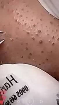 Салонный уход за кожей: глубокое очищение пор и омоложение