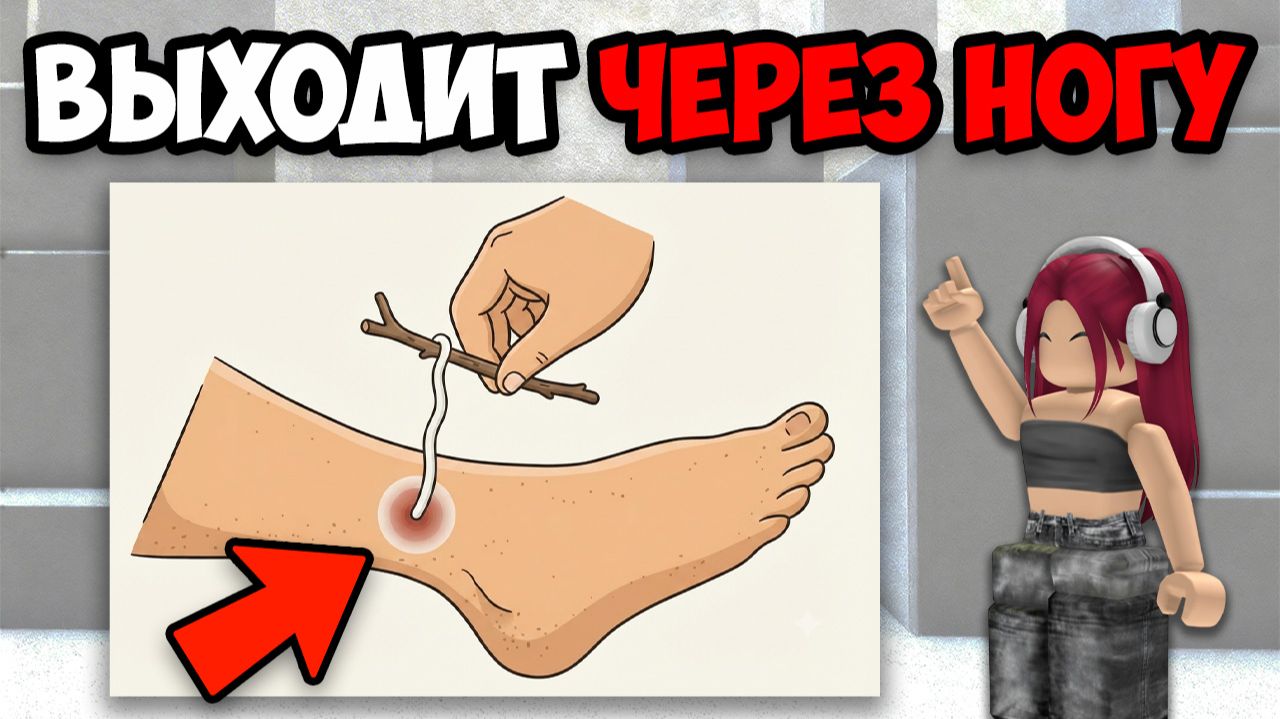 САМЫЕ ЖУТКИЕ ПАРАЗИТЫ В МИРЕ смотреть онлайн