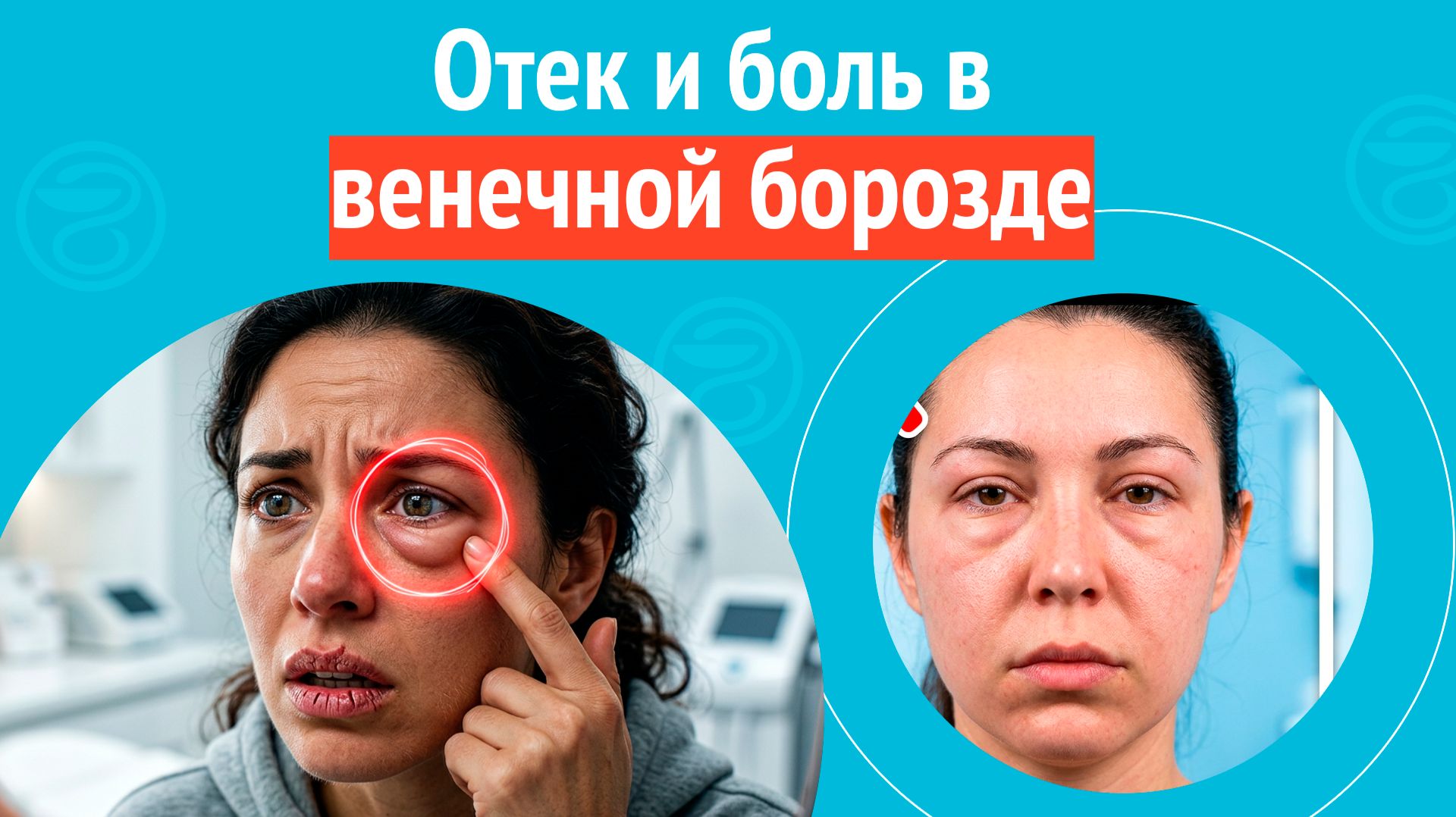 😬 Отек и боль в венечной борозде. Клинический случай № 1818