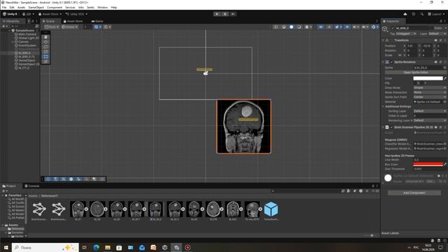 Разработка ИИ для анализа МРТ снимков и экспорт его в unity. смотреть онлайн