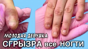 съела ногти в ноль 😣 обработали и сделали наращивание, как вам результат?