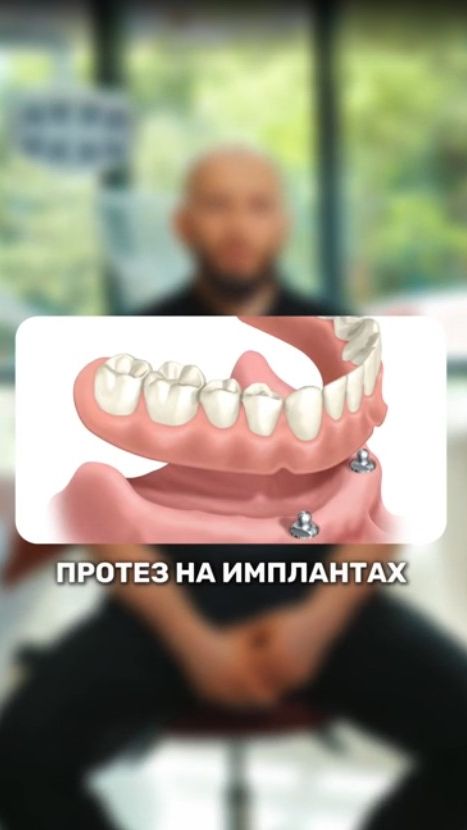 Если НЕТ DEНЕГ на ИМПЛАНТАЦИЮ 🤔🤷♂️