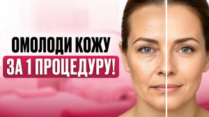 Биоревитализация от А до Я! Вся правда о процедуре, препаратах, осложнениях и реальном эффекте
