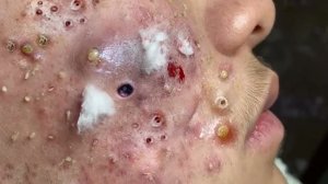 Очищение и омоложение кожи лица ✨