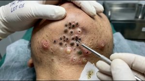 Успокаивающая процедура для лица для снятия стресса в спа-салоне