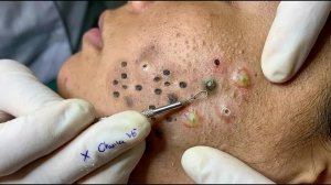 Успокаивающий уход за лицом для снятия стресса в спа-салоне