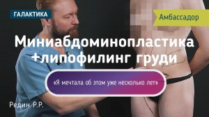 После двух родов живот остался беременным | Миниабдоминопластика у Романа Редина