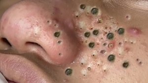 Расслабляющий уход за кожей: очищение
