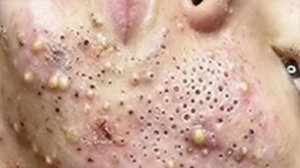 Успокаивающий уход за лицом для снятия стресса в спа-салоне