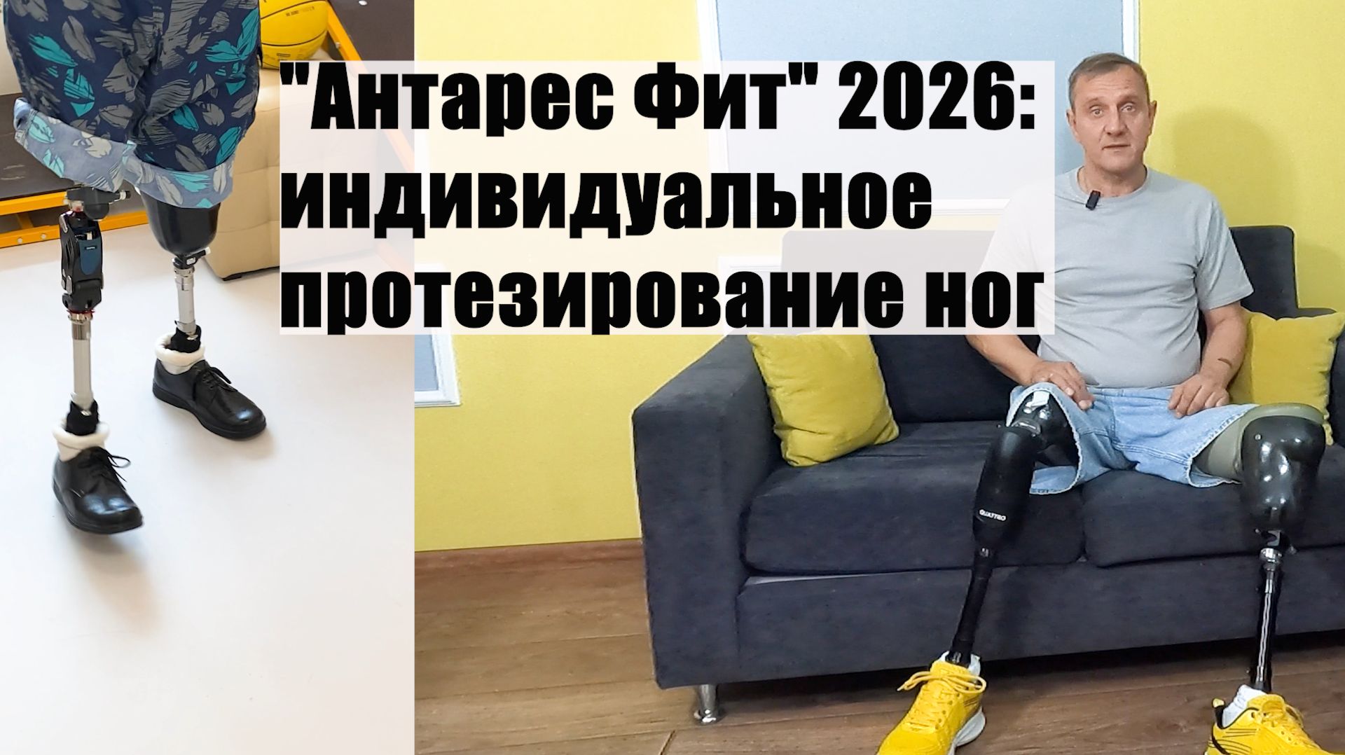 «Антарес Фит» 2026: индивидуальное протезирование ног.
